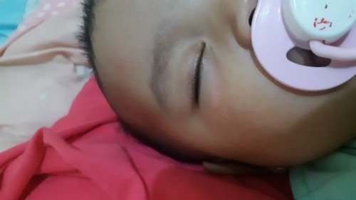 Kering dan Merah di bawah mata bayi