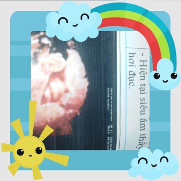 Dấu hiệu chuyển dạ em chưa thấy nhúc nhích gi ma cứ hay bị đau cơn co 😥