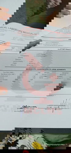 ano po ba pwde kong inumin ang hapdi po kasi ng ihi ko may lab na ako at may result na din