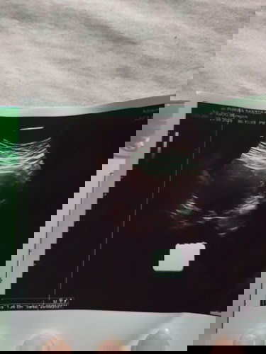 Mo tt bunda" yg d sini..ini artinya hamil 5w 4hari..hpl 28 mei 2021 apa ya buun?