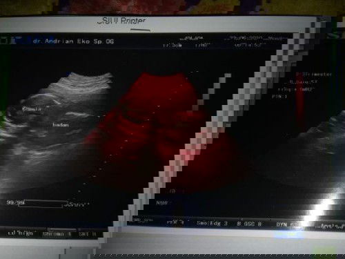 Pipis gg beraturan selama hamil