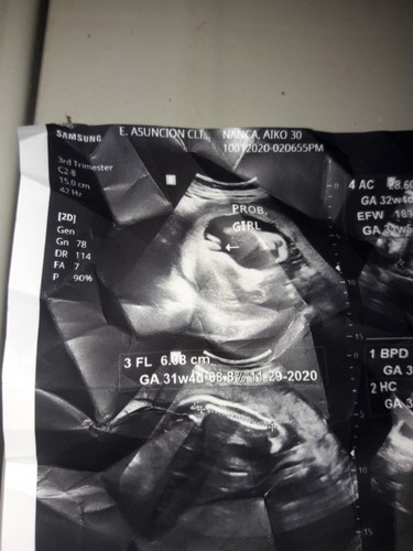 30 weeks pregnant