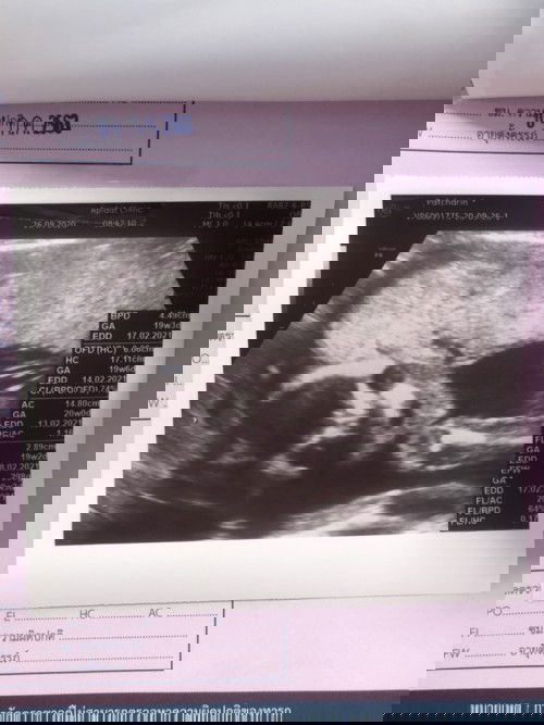 ท้องแรก 20สัปดาห์แม่บ้านไหนมือชาบ้างค่ะ