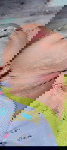 Ruam kulit bayi
