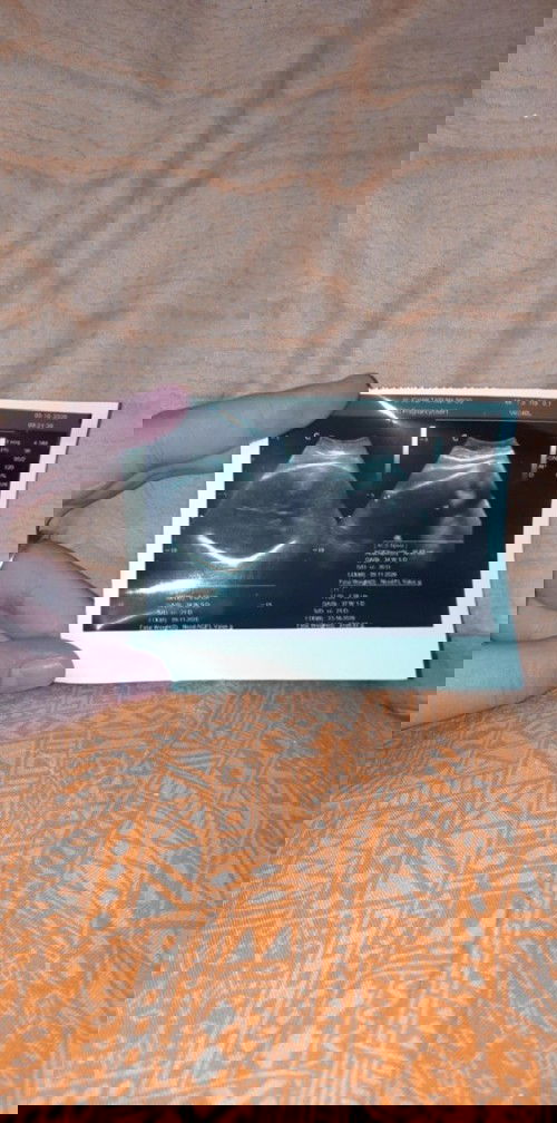 cara merangsang supaya kontraksi