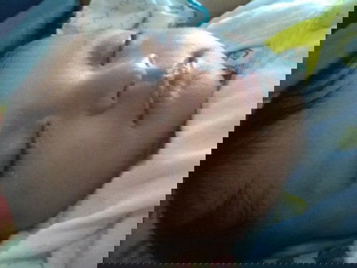 Bruntusan bayi umur 1 bulan