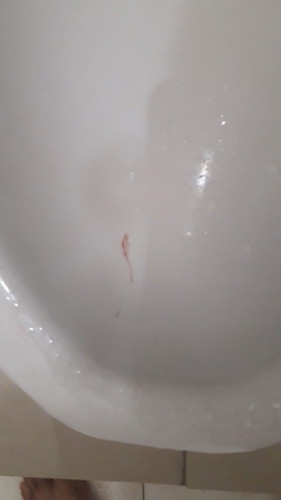 mau tanya apakah kalau kandungan umur 10 minggu ada yg ngeflek gak kayak saya?minta doanya ya bunda.