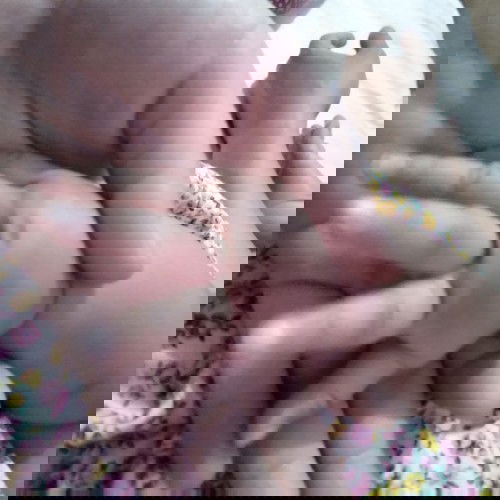 Bengkak digigit serangga