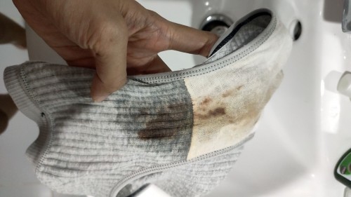 ใช่มูกเลือดไหม