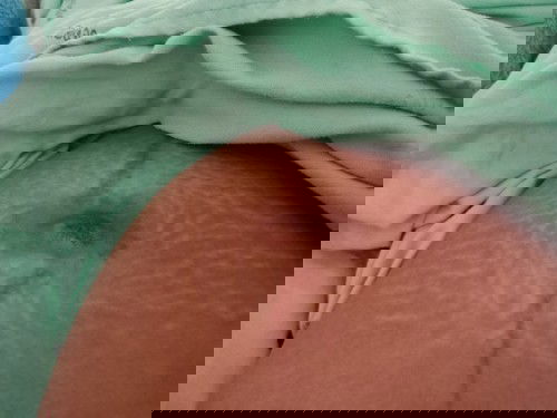 ท้องแรก #ความเจ็บปวดที่งดงาม