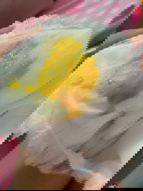 น้องถ่าย แต่ไม่ซึม สดใส ร่าเริง กินนมได้ปกติ