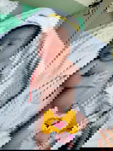 ผ่าคลอดคะรอแบบธรรมชาติไม่แตก