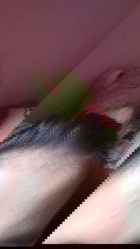 Brutusan/jerawatkecil2