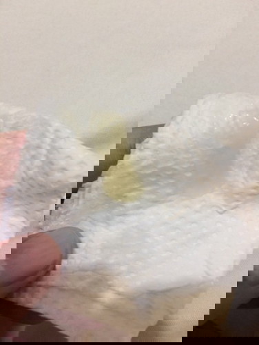 Mucus plug