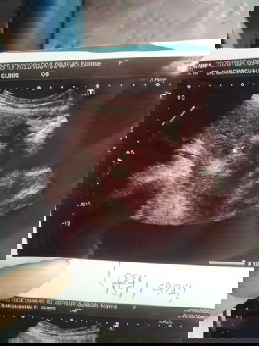 พึ่งซาวมาวันนี้ค่ะ22w6dแต่แม่ดูไม่ออก