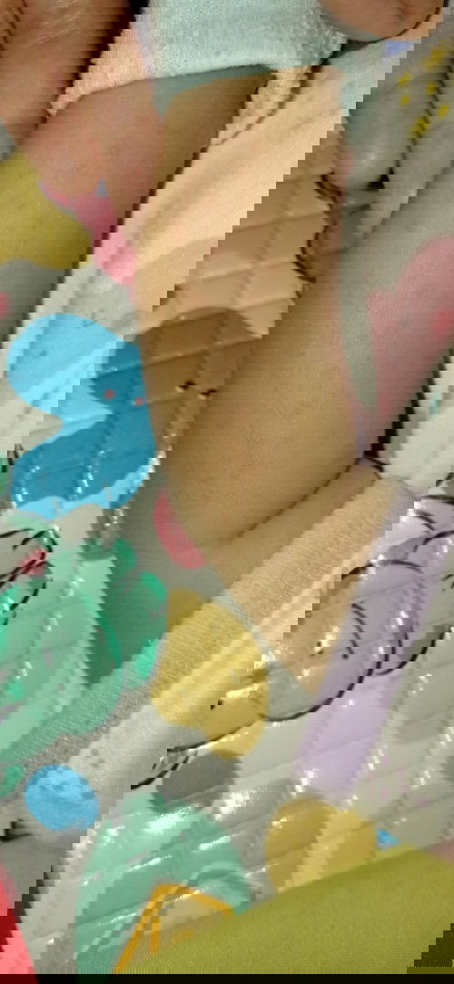 Tanda biang keringat atau tampek