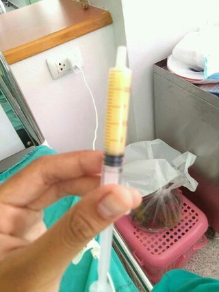 เพิ่มน้ำนมกู้น้ำนมบำรุงน้ำนม