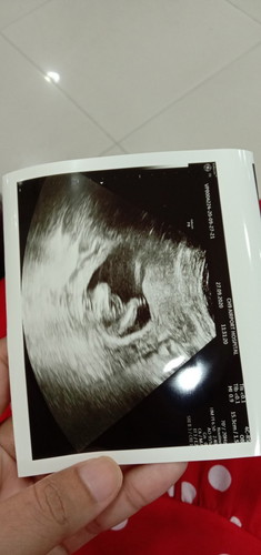 ขอคำแนะนำด้วยนะค่ะ