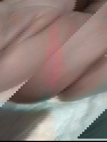 RASHES
