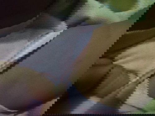 Merah2 sekitar ketiak dan paha