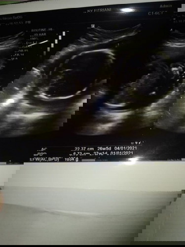 Alhamdulillah sudh 6 bln π