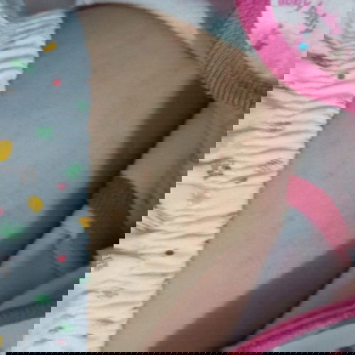 Biang keringat atau alergi??