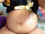 My baby bump