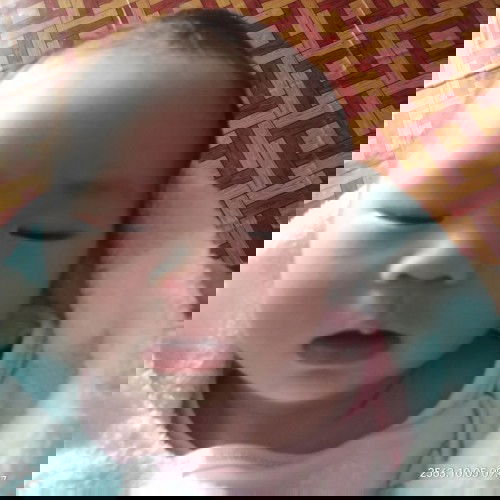 น้องเกิดได้12วันแก้มไม่เท่ากันจะเป็นอะมั้ยคับ ต้องไปหาหมอมั้ยคับ