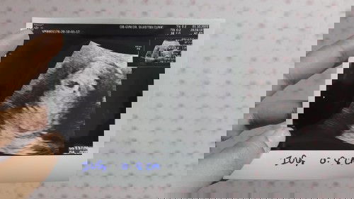 ท้องแรก แอบกังวล ตื่นเต้น