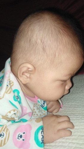 ลูก3เดือนหัวแบน