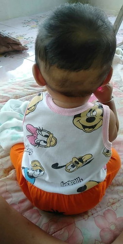 ผม