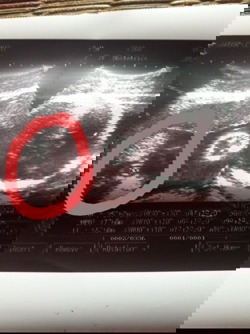 หญิงจริงไหมนะท้อง2ค่ะ