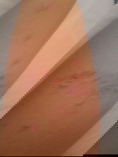 Please,kasih tau bun obatin nya gimana?😥