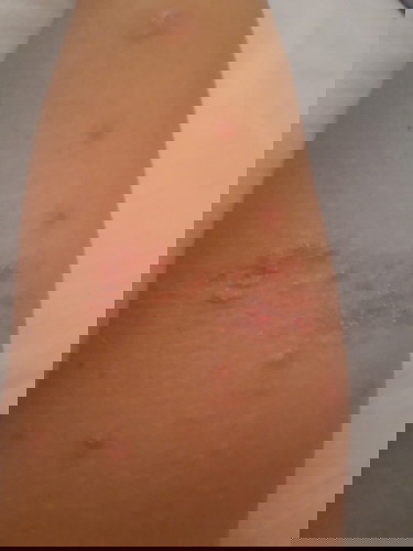 Please,kasih tau bun obatin nya gimana?😥