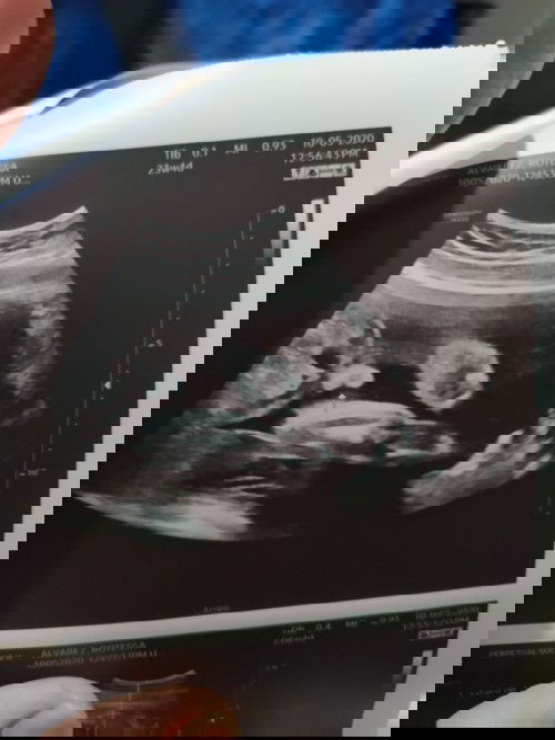 Baby boy po ba talaga ito? 😊