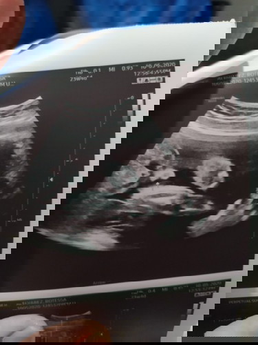 Baby boy po ba talaga ito? 😊