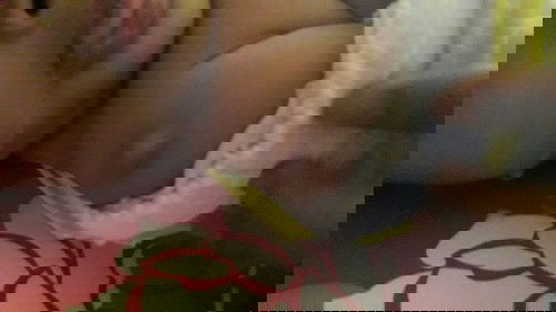 Benjolan 2 bulan setelah imunisasi