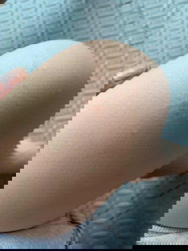 Toddler’s leg