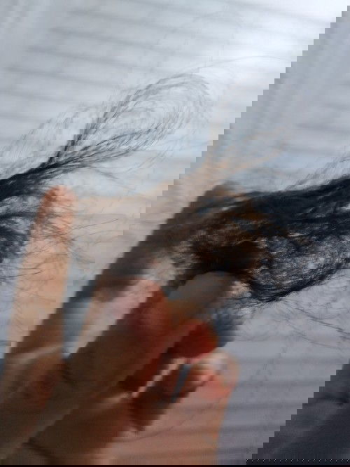 Rambut Rontok saat  hamil