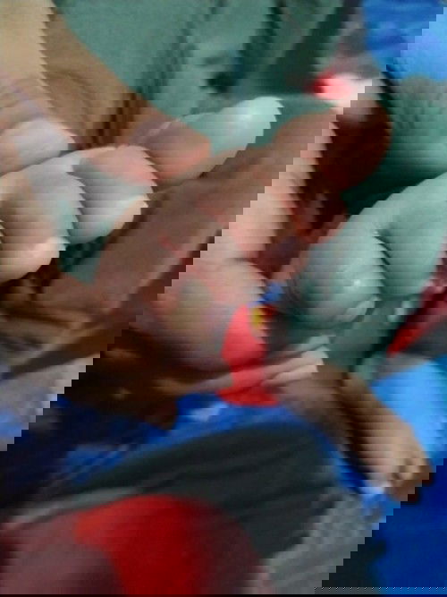 jari kelingking memutih