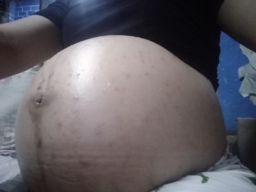 pregnancy care