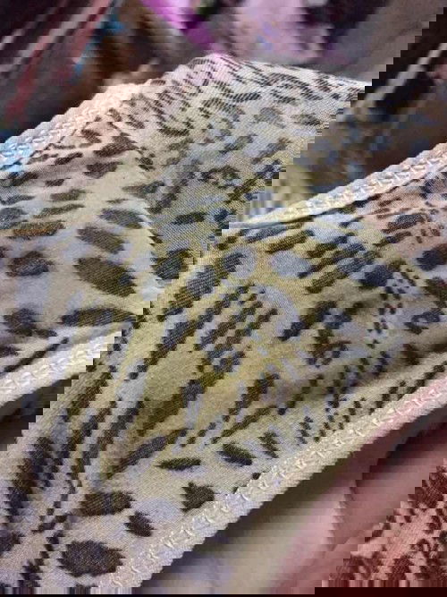 ตกขาว และมีอาการปวดต้นขาเป็นบ้างครั้งเหมือนจะเป็นตะคิว เดินหรือยืนแถบไม่ใด้เลยค่ะ