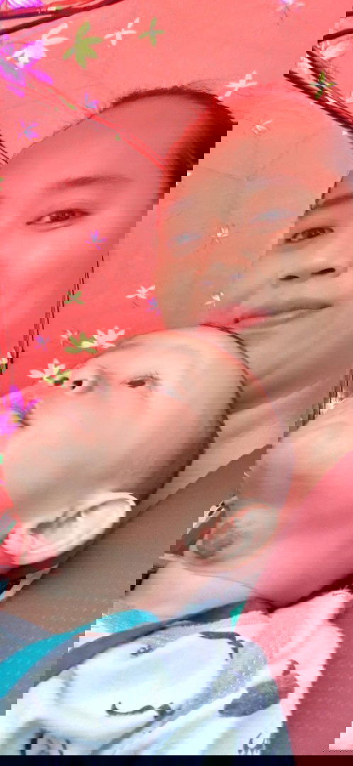 Bun ada gk anaknya kena hemangioma??