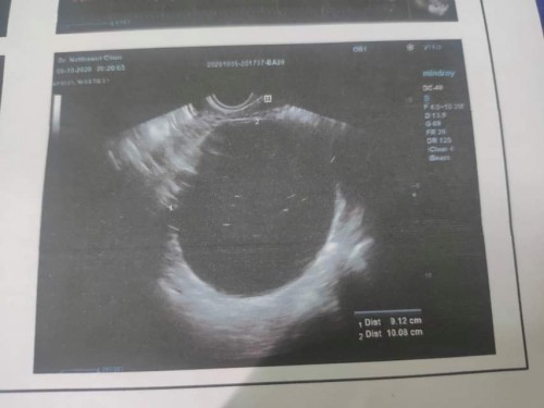 โชคดีในความโชคร้าย ขออย่าใช่เนื้อร้ายเถิด