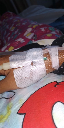 kista coklat,radang usus,hamil