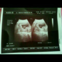 Folamil genio atau nutrimama