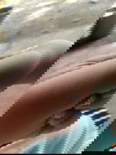 Butlig sa braso