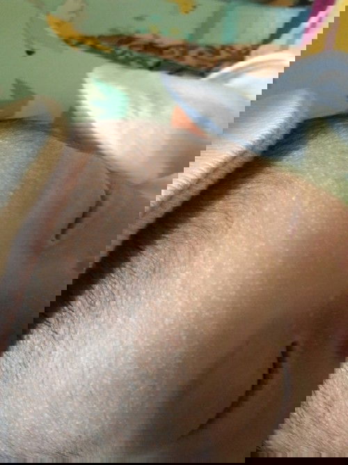 Bintik2 kecil..  Pakek apa ya biar ilang