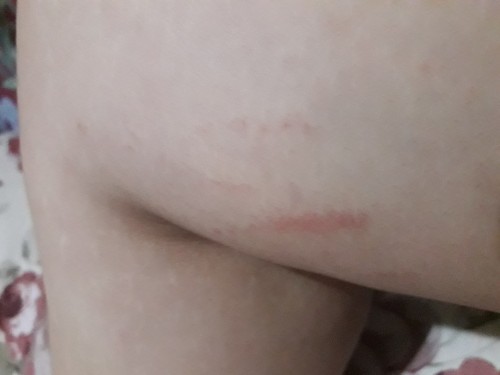 Kati kati after manganak