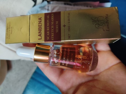 Lanbena for stretchmark